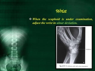  When the scaphoid is under examination,
adjust the wrist in ulnar deviation.
Wrist
 