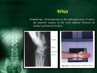Central ray : Perpendicular to the midcarpal area. It enters
the anterior surface of the wrist midway between its
medial and lateral borders.
Wrist
 