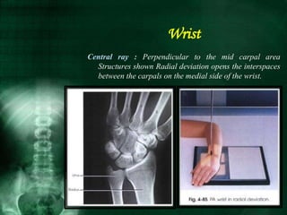 Central ray : Perpendicular to the mid carpal area
Structures shown Radial deviation opens the interspaces
between the carpals on the medial side of the wrist.
Wrist
 