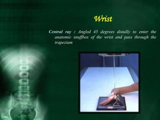 Central ray : Angled 45 degrees distally to enter the
anatomic snuffbox of the wrist and pass through the
trapezium
Wrist
 