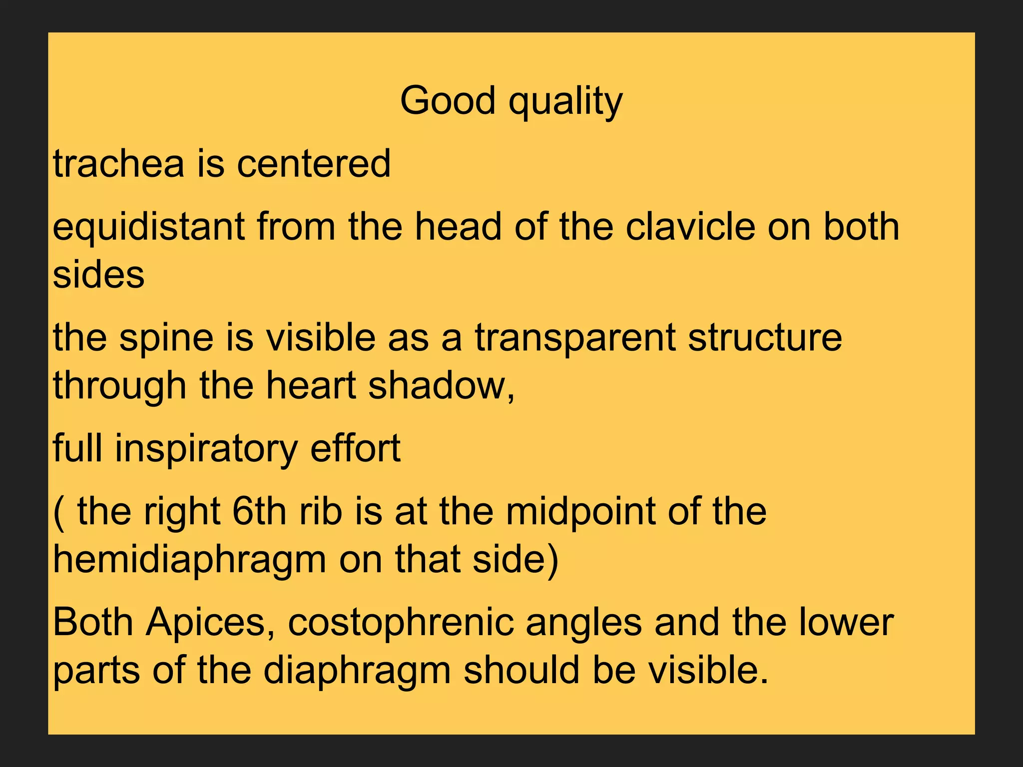 Good quality
trachea is centered
equidistant from the head of the clavicle on both
sides
the spine is visible as a transparent structure
through the heart shadow,
full inspiratory effort
( the right 6th rib is at the midpoint of the
hemidiaphragm on that side)
Both Apices, costophrenic angles and the lower
parts of the diaphragm should be visible.