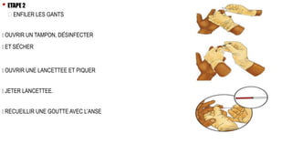 • ETAPE 2
ENFILER LES GANTS
OUVRIR UN TAMPON, DÉSINFECTER
ET SÉCHER
OUVRIR UNE LANCETTEE ET PIQUER
JETER LANCETTEE.
RECUEILLIR UNE GOUTTE AVEC L’ANSE
 