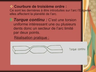 Courbure de troisième ordre : Ce sont les dernières à être introduites sur l’arc l’Edgwise, elles affectent la planéité de l’arc. Torque continu :  C’est une torsion uniforme intéressant une ou plusieurs dents donc un secteur de l’arc limité par deux points. Réalisation pratique : 