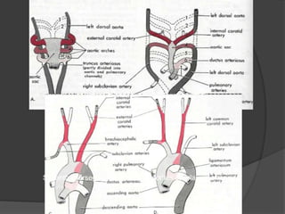 Seventh intersegmentary artery becomes subclavian artery
 