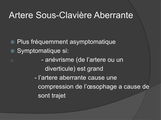 Artere Sous-Clavière Aberrante
 Plus fréquemment asymptomatique
 Symptomatique si:
o - anévrisme (de l’artere ou un
diverticule) est grand
- l’artere aberrante cause une
compression de l’œsophage a cause de
sont trajet
 