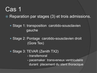 Cas 1
 Reparation par stages (3) et trois admissions.
 Stage 1: transposition carotido-sousclavien
gauche
 Stage 2: Pontage carotido-sousclavien droit
(Gore Tex)
 Stage 3: TEVAR (Zenith TX2)
- transfemoral
- pacemaker transveneux ventriculaire
durant placement du stent thoracique
 