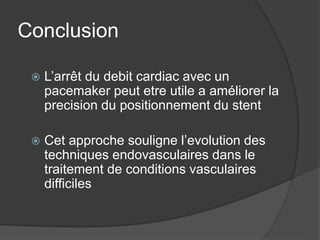 Conclusion
 L’arrêt du debit cardiac avec un
pacemaker peut etre utile a améliorer la
precision du positionnement du stent
 Cet approche souligne l’evolution des
techniques endovasculaires dans le
traitement de conditions vasculaires
difficiles
 