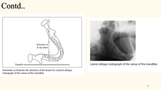 Technique of dental radiographic | PPTX