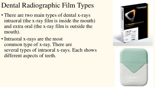 Technique of dental radiographic