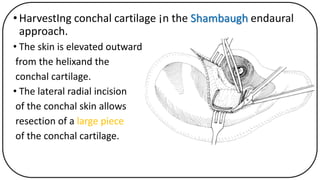 Technique of harvesting cartilage graft for cartilage tympanoplasty Dr ...