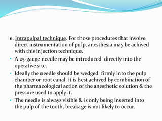 Pulp Injection Technique of maxillay anesthesia | PPTX