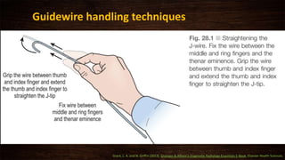Guidewire handling techniques
Grant, L. A. and N. Griffin (2013). Grainger & Allison's Diagnostic Radiology Essentials E-Book, Elsevier Health Sciences.
 