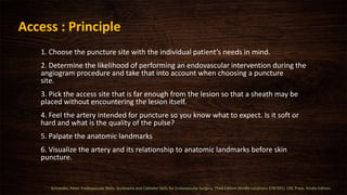 Access : Principle
1. Choose the puncture site with the individual patient’s needs in mind.
2. Determine the likelihood of performing an endovascular intervention during the
angiogram procedure and take that into account when choosing a puncture
site.
3. Pick the access site that is far enough from the lesion so that a sheath may be
placed without encountering the lesion itself.
4. Feel the artery intended for puncture so you know what to expect. Is it soft or
hard and what is the quality of the pulse?
5. Palpate the anatomic landmarks
6. Visualize the artery and its relationship to anatomic landmarks before skin
puncture.
Schneider, Peter. Endovascular Skills: Guidewire and Catheter Skills for Endovascular Surgery, Third Edition (Kindle Locations 578-591). CRC Press. Kindle Edition.
 