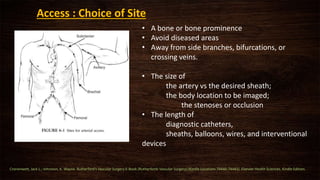 • A bone or bone prominence
• Avoid diseased areas
• Away from side branches, bifurcations, or
crossing veins.
• The size of
the artery vs the desired sheath;
the body location to be imaged;
the stenoses or occlusion
• The length of
diagnostic catheters,
sheaths, balloons, wires, and interventional
devices
Access : Choice of Site
Cronenwett, Jack L.; Johnston, K. Wayne. Rutherford's Vascular Surgery E-Book (Rutherfords Vascular Surgery) (Kindle Locations 74440-74441). Elsevier Health Sciences. Kindle Edition.
 