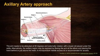 The arm needs to be abducted at 90 degrees and externally rotated, with a towel roll placed under the
axilla. Alternatively, the axillary region may be exposed by ﬂexing the arm at the elbow and placing the
hand behind or just above the head. A micropuncture needle access kit is recommended for access.
Axillary Artery approach
Andros, G. (2011). Arterial Access. Endovascular Surgery: 49-58.
 