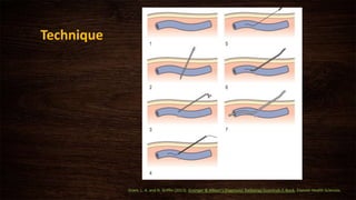 Technique
Grant, L. A. and N. Griffin (2013). Grainger & Allison's Diagnostic Radiology Essentials E-Book, Elsevier Health Sciences.
 