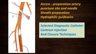 Access : preparation artery
puncture site and needle
Sheath preparation
Hydrophilic guidewire
Selected Diagnostic Catheter
Contrast injection
And Closure Techniques
 