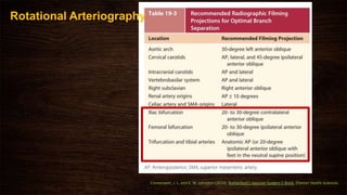 Rotational Arteriography
Cronenwett, J. L. and K. W. Johnston (2014). Rutherford's Vascular Surgery E-Book, Elsevier Health Sciences.
 