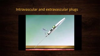 Intravascular and extravascular plugs
 