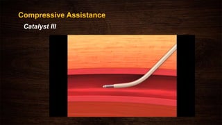 Compressive Assistance
Catalyst III
 