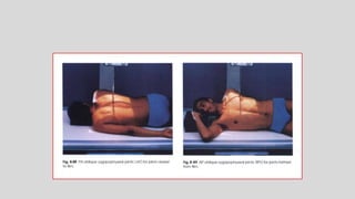 Twining Method Radiography Technique of thoracic and lumber spine radiography | PPTX