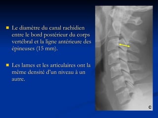 Le diamètre du canal rachidien entre le bord postérieur du corps vertébral et la ligne antérieure des épineuses (15 mm). Les lames et les articulaires ont la même densité d’un niveau à un autre. 