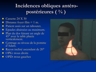 Incidences obliques antéro-postérieures ( ¾ )  Cassette 24 X 30  Distance foyer film = 1 m. Patient assis sur un tabouret. Epaules abaissées au maximum. Plan du dos faisant un angle de 45° avec la table placée verticalement. Centrage au niveau de la pomme d’Adam. Rayon incliné ascendant de 20° OPG: trous droits OPD: trous gauches 