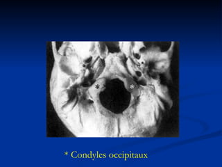 * Condyles occipitaux 