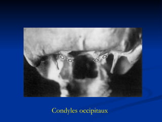 Condyles occipitaux 