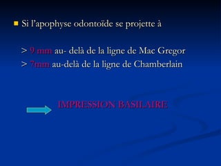 Si l’apophyse odontoïde se projette à  >  9 mm  au- delà de la ligne de Mac Gregor >  7mm  au-delà de la ligne de Chamberlain IMPRESSION BASILAIRE 