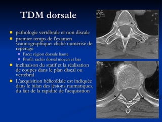 TDM dorsale pathologie vertébrale et non discale  premier temps de l'examen scannographique: cliché numérisé de repérage Face: région dorsale haute Profil: rachis dorsal moyen et bas inclinaison du statif et la réalisation de coupes dans le plan discal ou vertébral  L'acquisition hélicoïdale est indiquée dans le bilan des lésions raumatiques, du fait de la rapidité de l'acquisition   