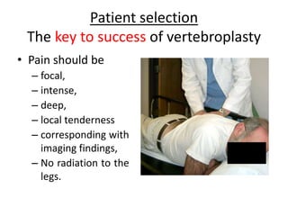Patient selection
The key to success of vertebroplasty
• Pain should be
– focal,
– intense,
– deep,
– local tenderness
– corresponding with
imaging findings,
– No radiation to the
legs.
 