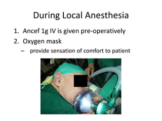 During Local Anesthesia
1. Ancef 1g IV is given pre-operatively
2. Oxygen mask
– provide sensation of comfort to patient
 