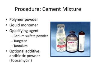Procedure: Cement Mixture
• Polymer powder
• Liquid monomer
• Opacifying agent
– Barium sulfate powder
– Tungsten
– Tantalum
• Optional additive:
antibiotic powder
(Tobramycin)
 