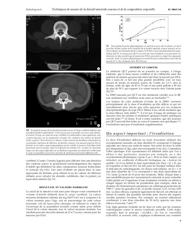 Techniques de mesure de la densité minérale osseuse et de la