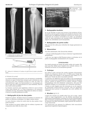 Techniques d’exploration d’imagerie de la jambe | PDF