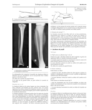 Techniques d’exploration d’imagerie de la jambe