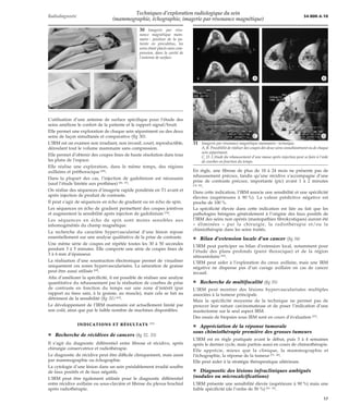 Techniques d’exploration radiologique du sein (mammographie, | PDF