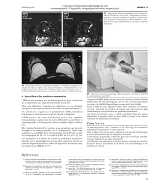 Techniques d’exploration radiologique du sein (mammographie, | PDF