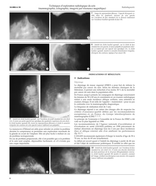 Techniques d’exploration radiologique du sein (mammographie, | PDF