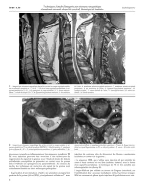 Techniques d'étude d'irm et anatomie normale du rachis cervi | PDF