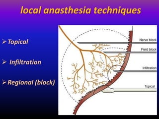 local anasthesia techniques
Topical
 Infiltration
Regional (block)
 