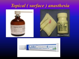 Topical ( surface ) anasthesia
 