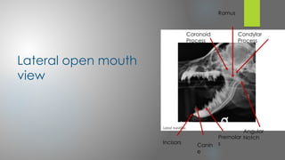 Techniques for Mandible Radiography-1.pptx