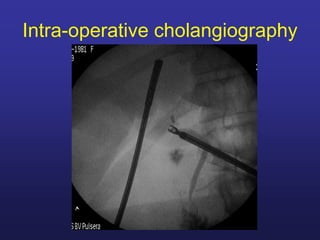 TECHNIQUES FOR THE DIFFICULT GALLBLADDER.pdf