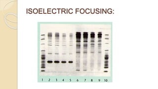 ISOELECTRIC FOCUSING:
 