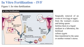 Techniques involved in assisted reproductive technology | PPTX