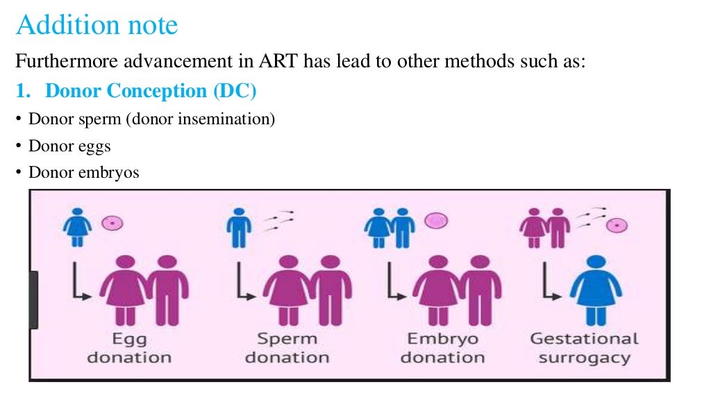 Techniques involved in assisted reproductive technology