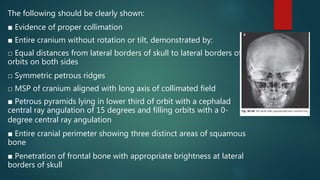 Technique skull x ray | PPTX