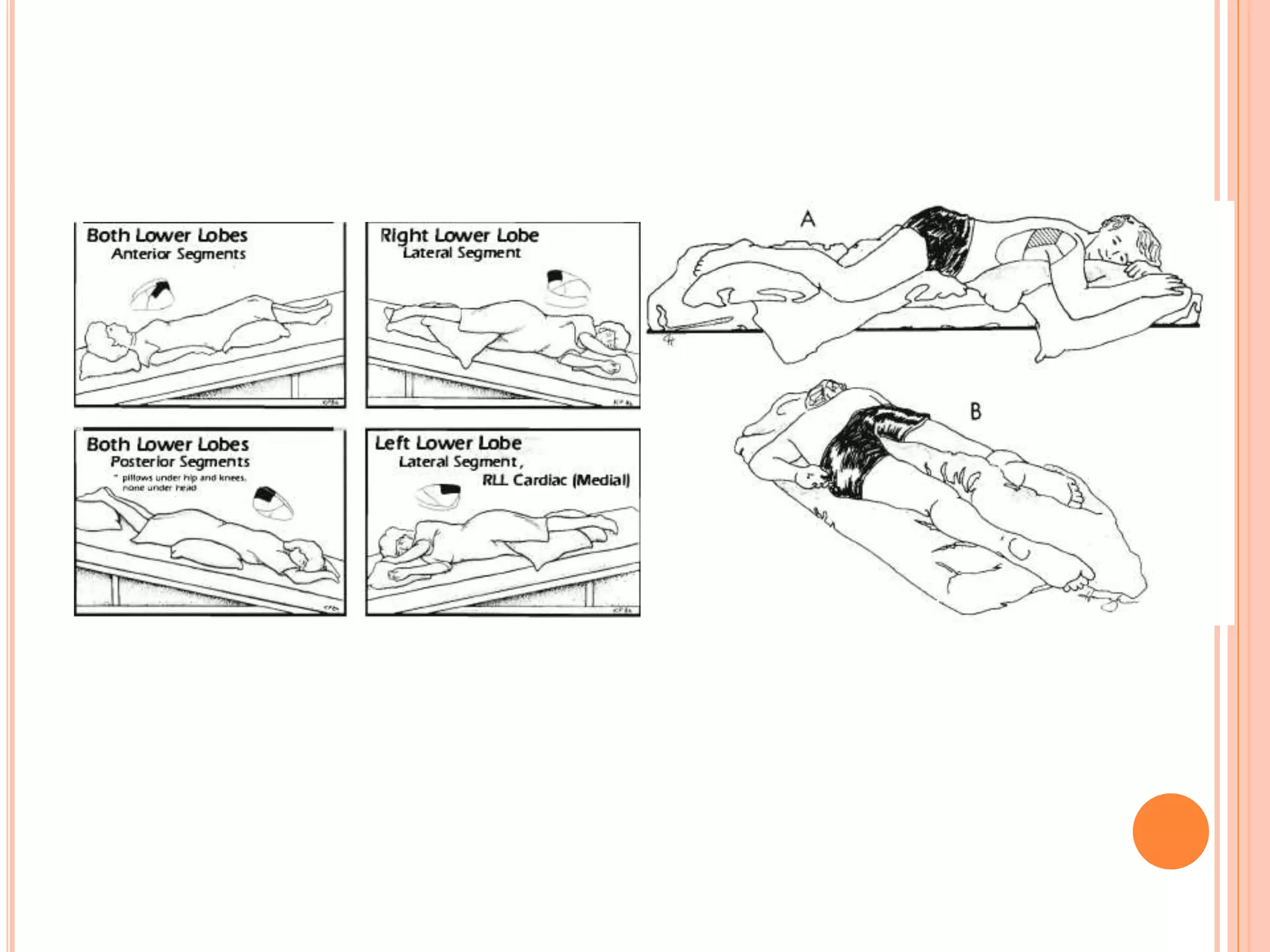 Techniques of chest physiotherapy | PPTX